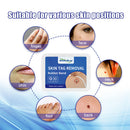 Rubber Skin Tag Remover Device Painless Safe Easy To Use Face Care Beauty Tools
