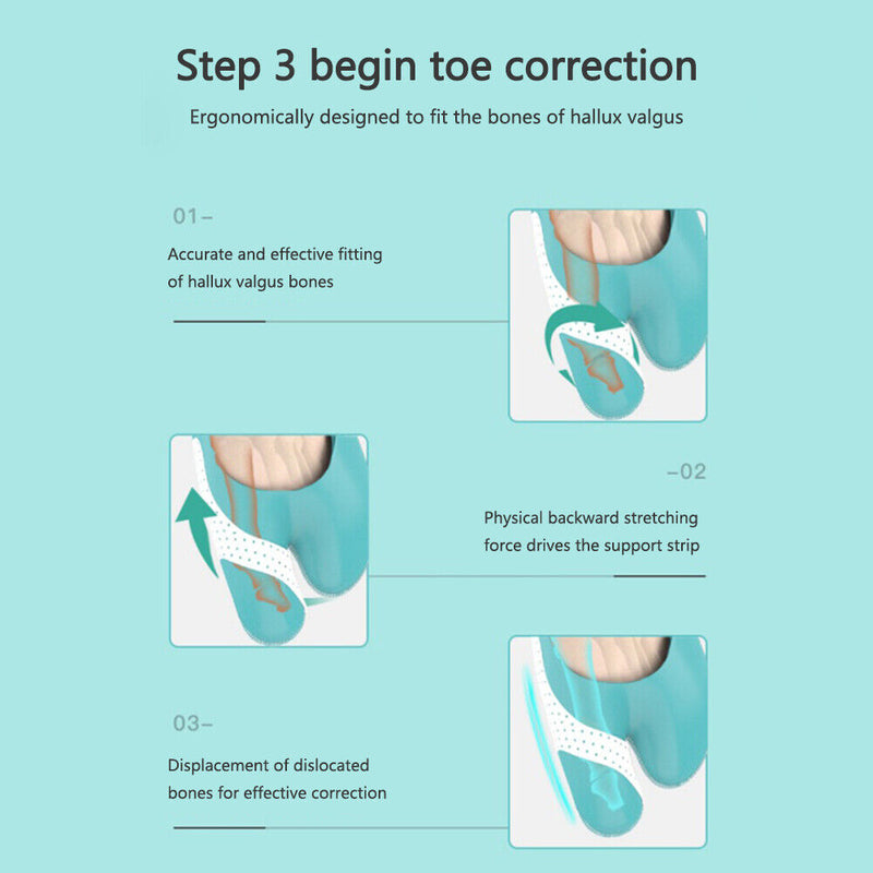 Toes Separator Foot Care Tools Hallux Valgus Orthotics Bone Thumb Correctors