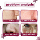 Fruit Acid Essence Granules Active Lotion Shrink Pore Facial Essence_