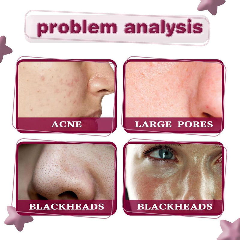 Fruit Acid Essence Granules Active Lotion Shrink Pore Facial Essence_