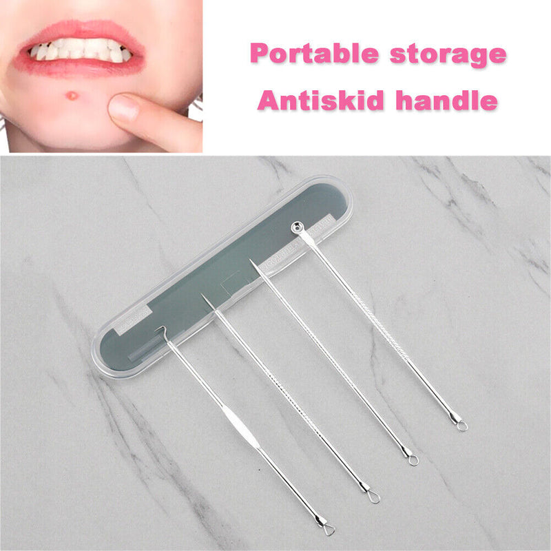 4pcs Durable Acne Needle Hook Set Pimple Spot Cleaning Needle Beauty Care Tool