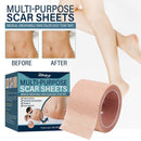 Skin Tone Concealer Tattoo Stickers Cover Up Scars Birthmark Patch Waterpro