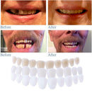 Silicone Simulated Tooth Cover Teeth Whitening Denture Paste Instant Smile