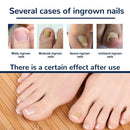 ?50pcs?2022 Fertoe Toenail Corrector Patch Ingrown Toe Nail Correction Stickers