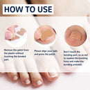 ?50pcs?2022 Fertoe Toenail Corrector Patch Ingrown Toe Nail Correction Stickers