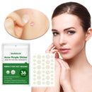 36 Patches Waterproof Acne Pimple Patch Stickers Acne FAST Pimple Remover H8K1