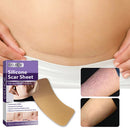 Self-Adhesive Scar Repair Stickers Silicone Scar Invisible Pad for Skin Beauty