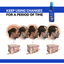 30ml Hair Fast Grow Spray Oil Ginger Plant Essence Men Women Hair Loss Treatment