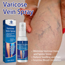 Varicose Vein Spray Improve Blood Circulation Soothing Leg Acid Bilges Itch