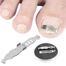 Ingrown Toenail Correction Tools Pedicure Recover Embed Toenail Treatment