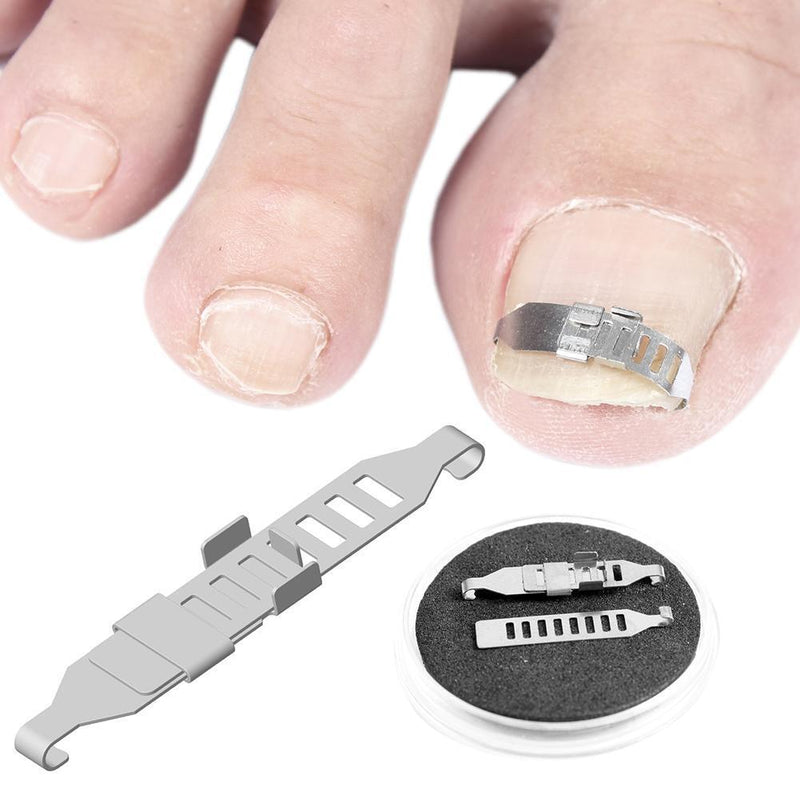 Ingrown Toenail Correction Tools Pedicure Recover Embed Toenail Treatment