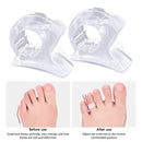 Toe Separator Insoles Ring Feet Care Toe Orthopedic Products Bunion Corrector