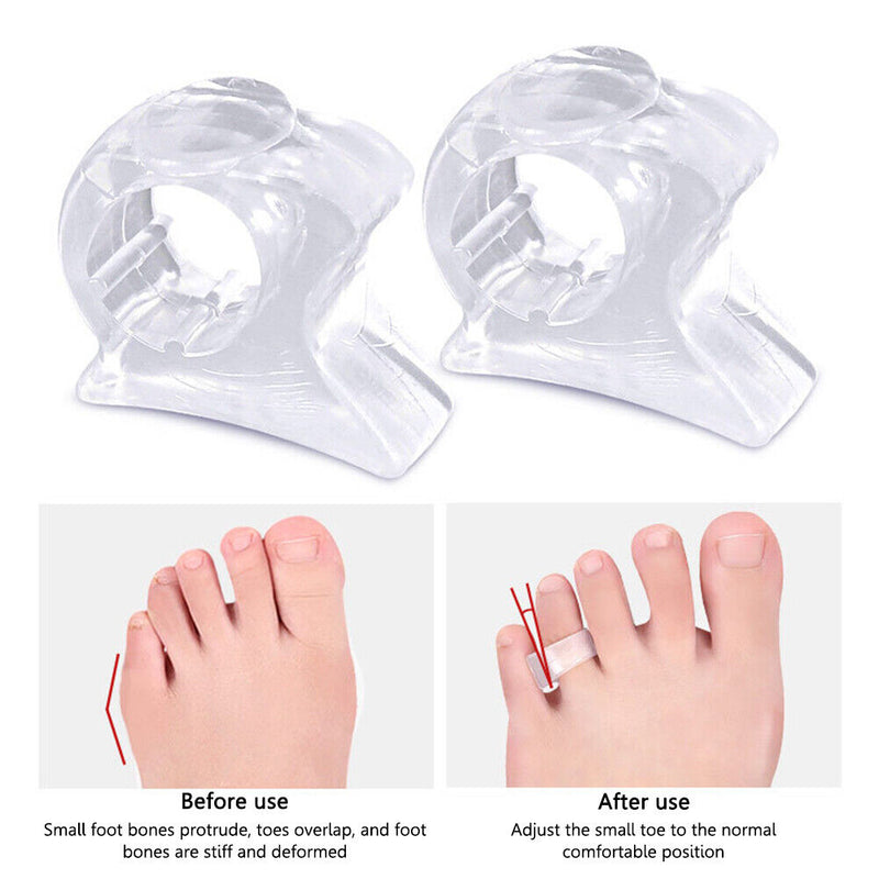 Toe Separator Insoles Ring Feet Care Toe Orthopedic Products Bunion Corrector