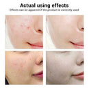 Eelhoe 10ML Instant Perfection Serum Pore Shrinking Serums P2T8