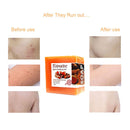 Turmeric Soap Face Cleansing Anti-Acne Skin Brighten Remove Dark Spot Whitening