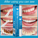 Smile Clean Oral Hygiene Teeth Gel Whitener Whitening Pen Teeth Whitening