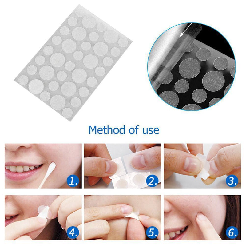 36pcs/bag Acne Pimple Master Patches Face Spot Scar Care Treatment Stickers