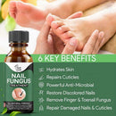 Fungal Nail Repair Essence Care Treatment Whitening Foot Nail Gel T6W5