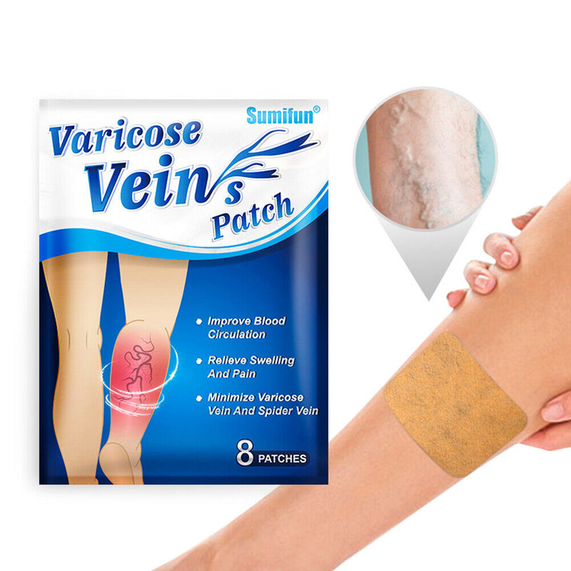 Varicose Vein Treatment Patches Pain Relief Vasculitis Phlebitis Herbal Pla