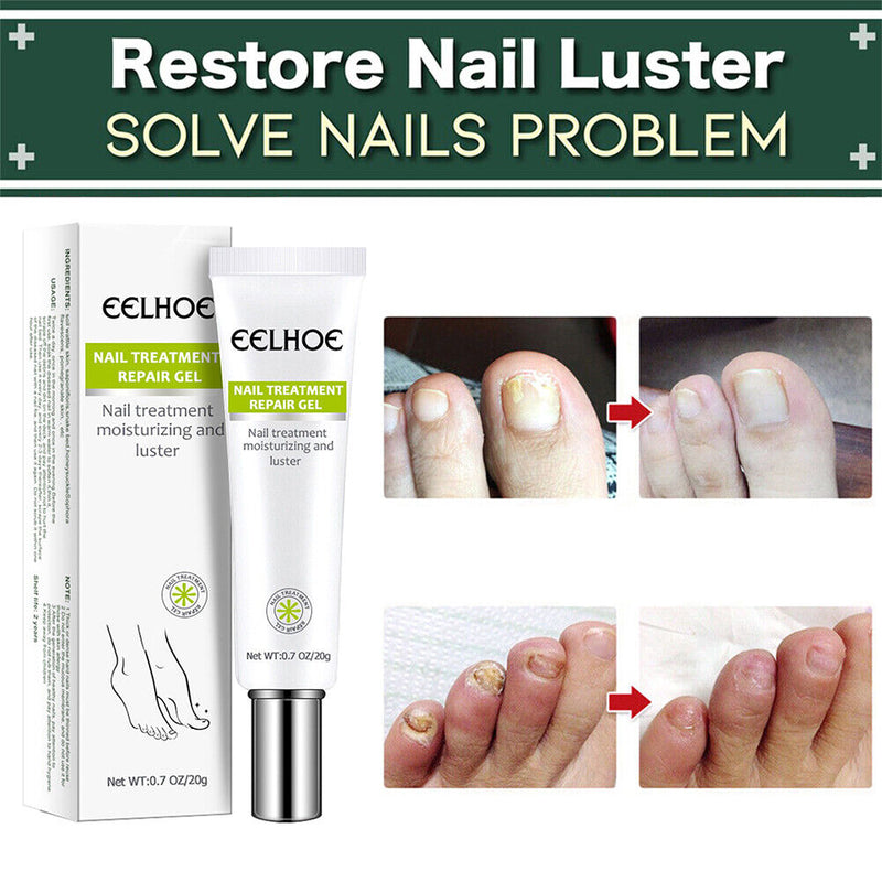 Gel Anti Infection Paronychia Treatment Toe Health Foot Care