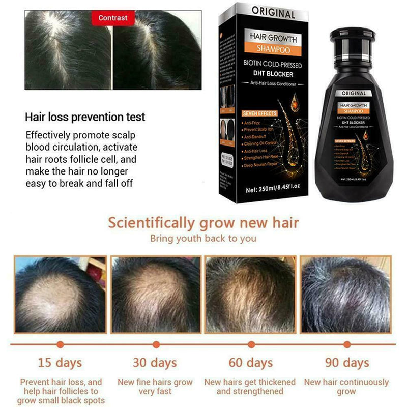 250ml Polygonum Shampoo Ginger Bar Moisturizing Refreshing Hair Control Oil D4G0