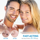 #A Skin Meat Grain Remover Cones Mole Wart Easy Clean Skin Care Tool for Face Ne