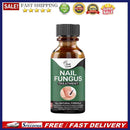 Nail Fungus Treat Onychomycosis Toe Treat Feet Care Nail Repair Anti Infectio