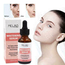 30ml Skin Whitening Lightening Brightening Serum Dark I2R7 Spot K8Y4 C6C5