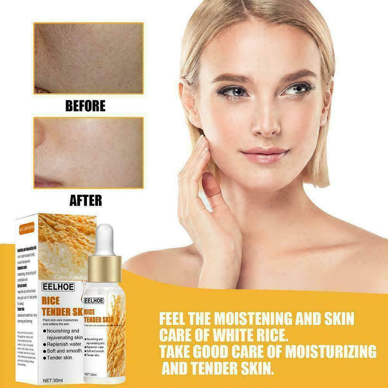 White Rice Whitening Serum Moisturizer Acne Fine Line C1N1 Treatment B4R6