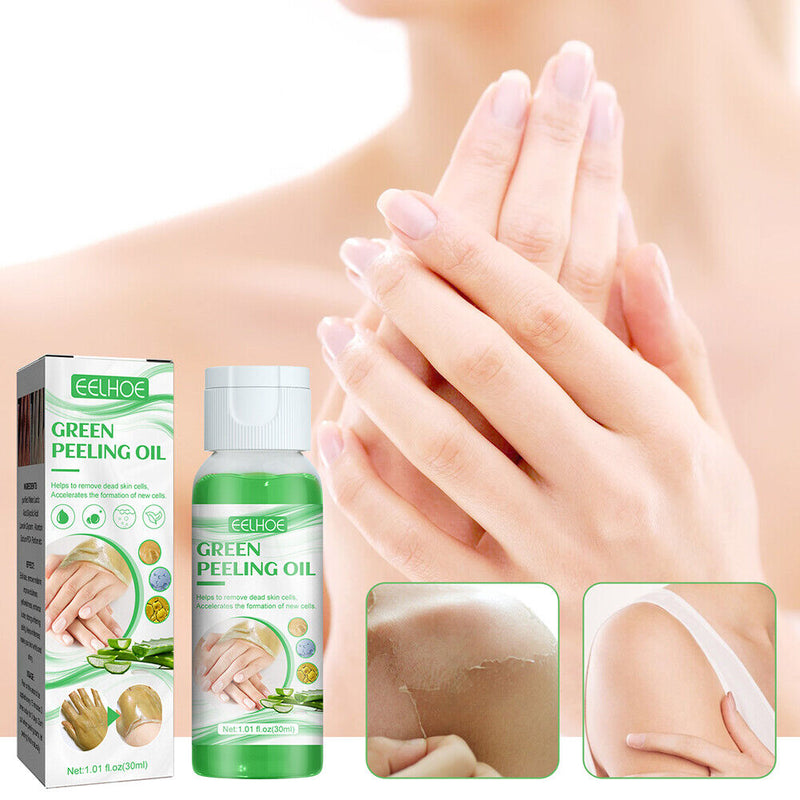 30ml Peeling Oil Lightening Acne Dark Patches Peeling Lotion Oil for Knee Ankle