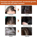 Instant Hair Regrowth Shampoo Hair loss Prevention Shampoo Anti Hairs Loss{