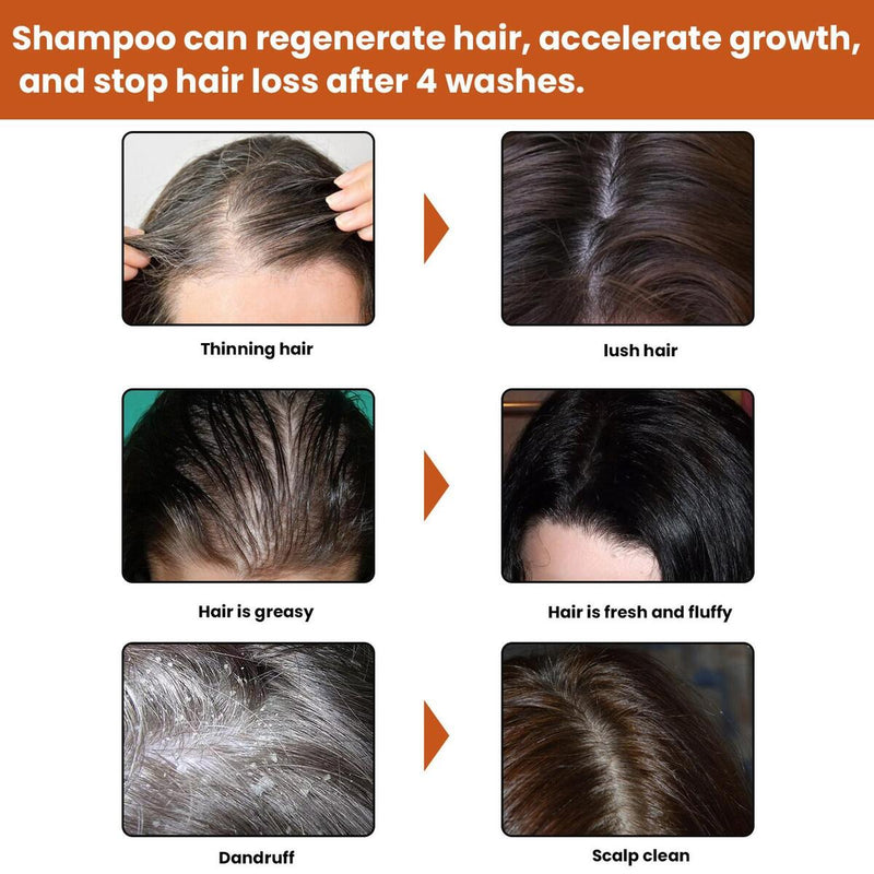 Instant Hair Regrowth Shampoo Hair loss Prevention Shampoo Anti Hairs Loss{
