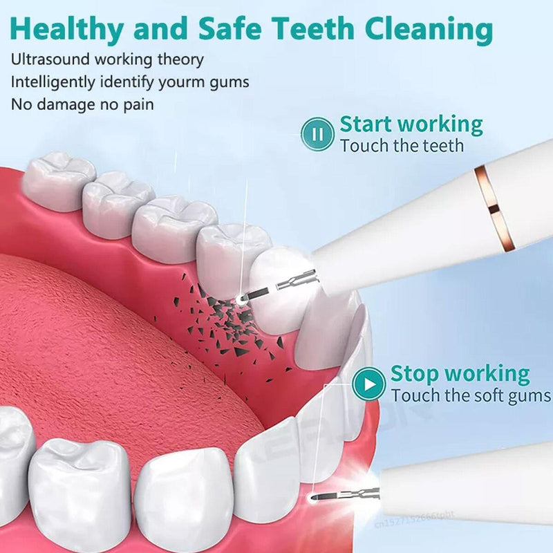 Electric Teeth Cleaning Professional Dental Calculus Plaque Remover Tools Kit~