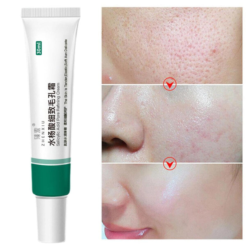 Salicylic Acid Moisturizing Nourish Smooth Pores Repair Essence Products 30ml.