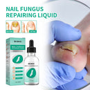 Toenail Fungus Oil Nail Repair Liquid for Fingernails Whitening Toe Feet Ca