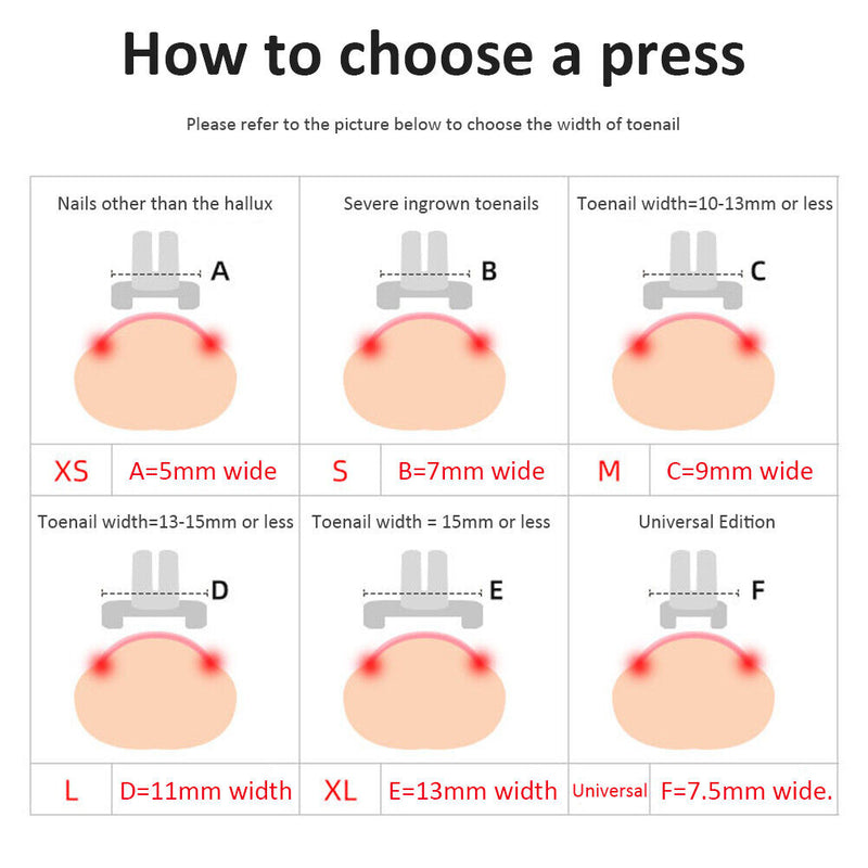 Fixer Ingrown Nail Correction Tool Pedicure Foot Embed Nails Care Corrector Set