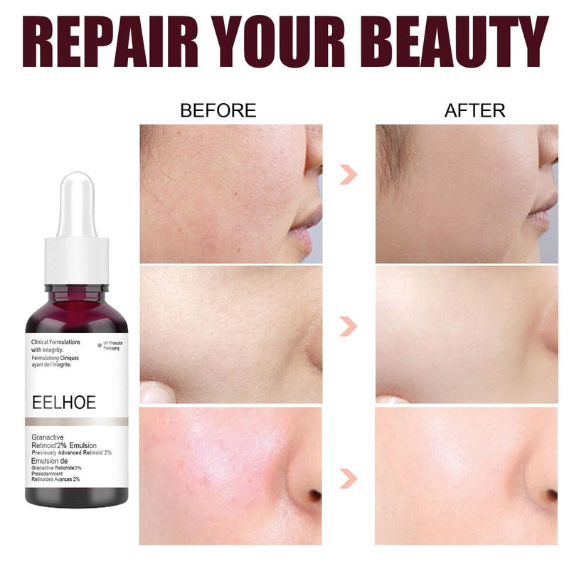 Exfoliating Pores Repair Fruit Acid Shrink Pores Skin Care Salicylic Acid