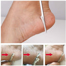 Foot Scraper File Hard Skin Remover Foot Callus Shaver Pedicure with 10 Blades