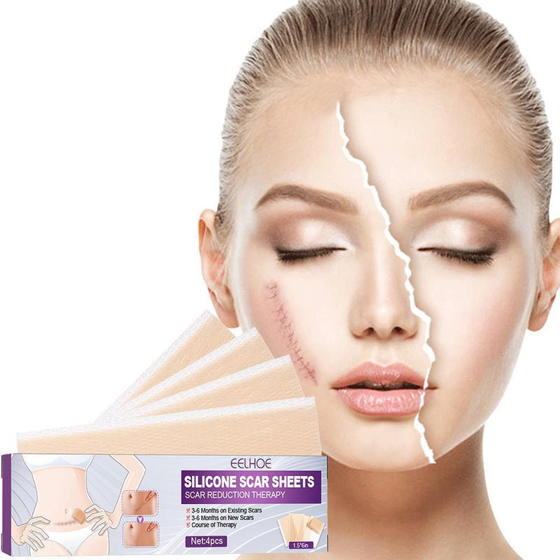 4pcs Silicone Scar Sheets Gel Strips Patch Adhesive Scar Removes (150mm)