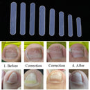Ingrown Corrector Stickers Fingernail Toe Treatment Nail Care Repairing Patch
