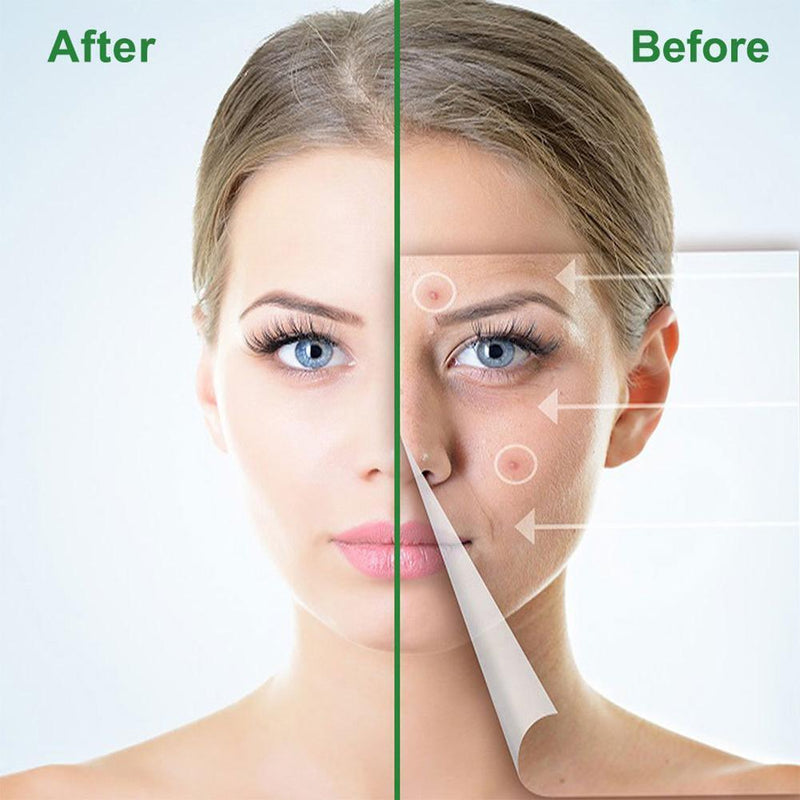 24pcs Ultra-thin Acne Pimple Remover Patches Acne Treatment Stickers Kit