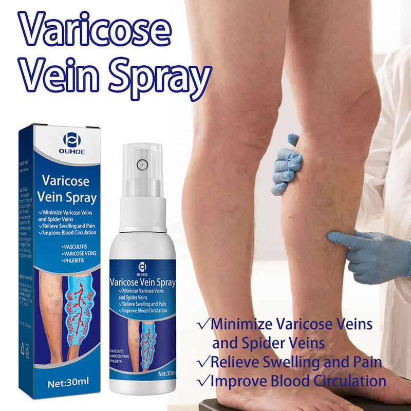 Varicose Vein Spray Improve Blood Circulation Sooting Leg Acid Bilges Itching