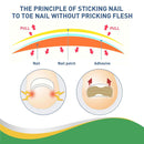Ingrown Toenail Correction Stickers Nail Corrector Patches Nail Care Tool!