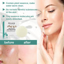 Silk Protein Soap Oil Control Face Deep Cleansing Mites Acne Remover Handmade