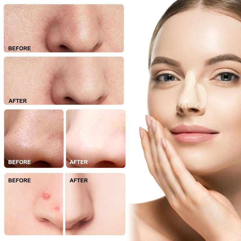 Hydrocolloid Nose Pads Acne Absorbing Forehead Nose Chin Shrink Pores Pimples`