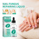 30ml Toenail Fungus Oil Nail Repair Liquid for Fingernails Anti Fungal Whitening