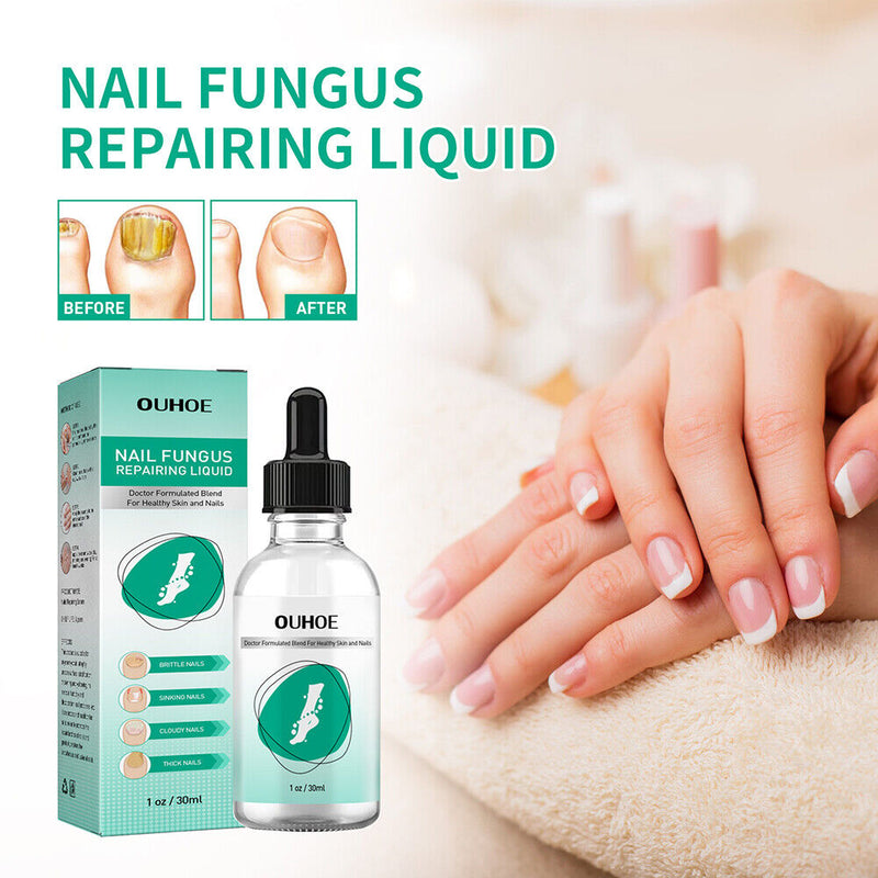 30ml Toenail Fungus Oil Nail Repair Liquid for Fingernails Anti Fungal Whitening