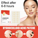 Master Ance Pimple Patches Acne Spot Treatment Skin Tag Remover Patch