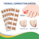 50pcs Paronychia Treatment Patch Waterproof Recover Corrector Pedicure Tool