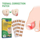 50pcs Paronychia Treatment Patch Waterproof Recover Corrector Pedicure Tool
